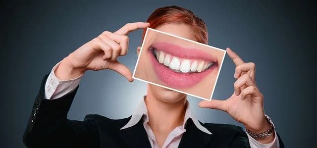 Tratamiento de Blanqueamiento Dental en Madrid