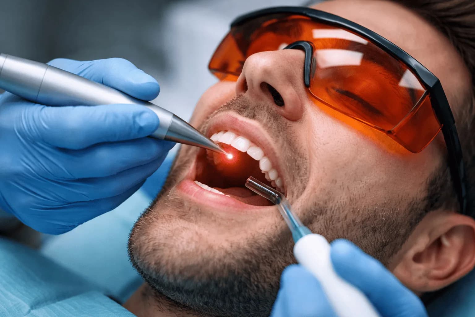 Tratamiento periodontal con láser en Mesena Dental